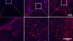 突破：科学家准备利用葡京赌博网站基于抗体的新洞察力来解